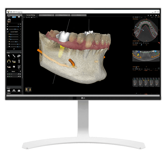 Kodak Dental Imaging Software Viewer Download Free